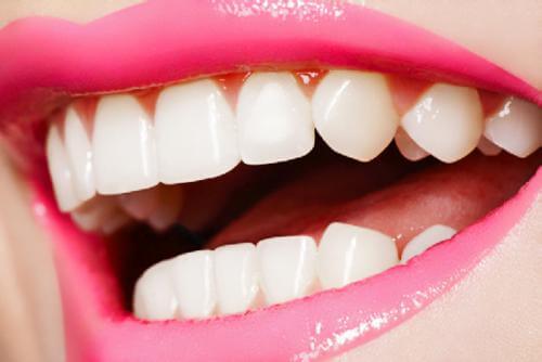 Какие бывают зубные протезы?